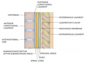 epidural placement