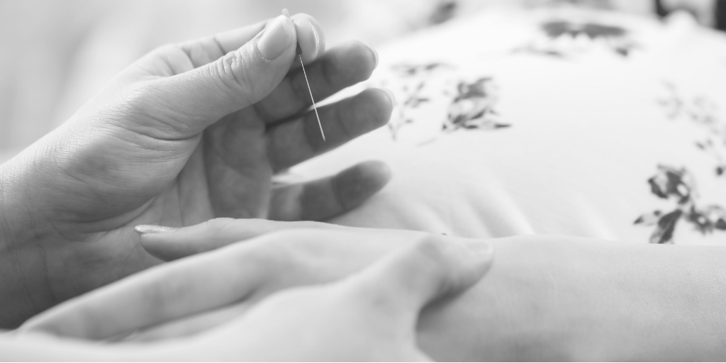 acupuncture and pregnancy