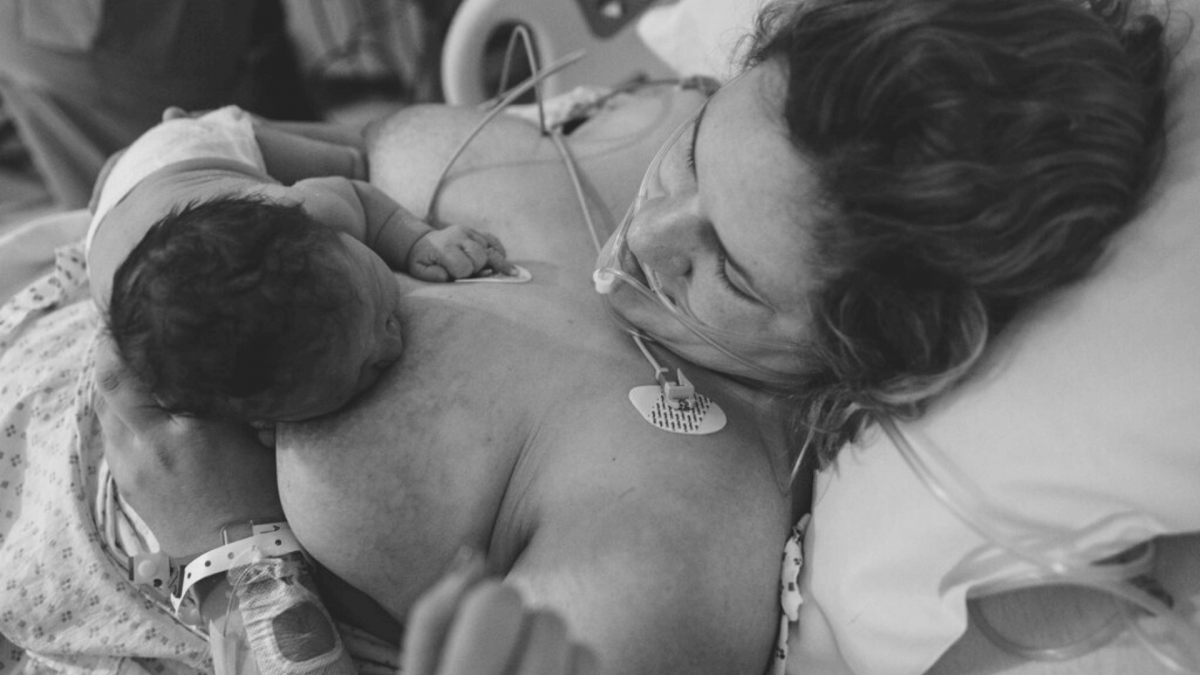 breastfeeding after a c section